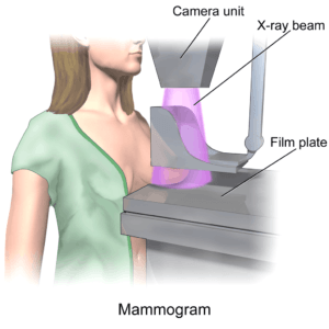 Brustkrebs Früherkennung: Mammographie, Sonographie und Kernspintomographie